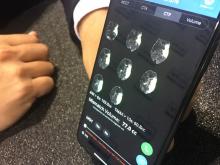 Brain images that have been pre-reviewed by the Viz.AI artificial intelligence software to identify a stroke. The software automatically sends and alert to the attending physician's smartphone with links to the imaging for a final human assessment to help speed the time to diagnosis and treatment. Depending on the type of stroke, quick action is needed to either activate the neuro-interventional lab or to administer tPA.