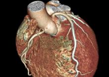 Top stories of 2012 in cardiology