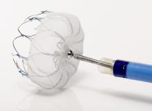 Boston Scientific Watchmen Left Atrial Appendage Closure Atrial Fibrillation 