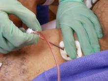 Access site complications, hemostasis management, vascular closure