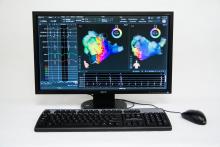 Biosense Webster, Thermocool Smarttouch 