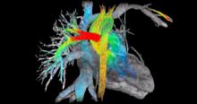 ViosWorks, cardiac MRI