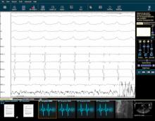 McKesson Cardiology, CVIS, cardiovascular information system, cardiac PACS, ep reporting system