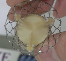 TAVR, transcatheter heart valves, GlobalData, TMVR 