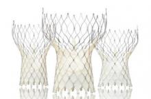 ESC Heart Valve Repair Hybrid OR Clinical trial/study