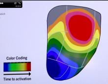 Toshiba, activation imaging, ACC, 2013