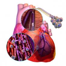 Stem Cells might be used to restore heart function by replacing the dead heart muscle following myocardial infarctions.