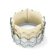 The Sapien will likely become the first transcatheter aortic valve cleared for use in the United States. However, its use will likely be limited to a small number of specialized centers. It is used for transcatheter aortic valve replacement (TAVR), also called implantation, or TAVI.