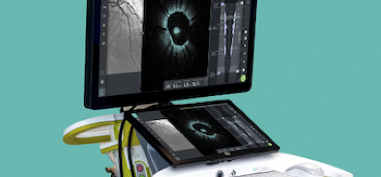 Gentuity, GE Healthcare, imaging, intravascular