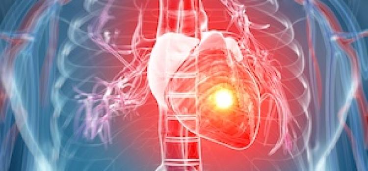 Global Experts Update Heart Failure Definition