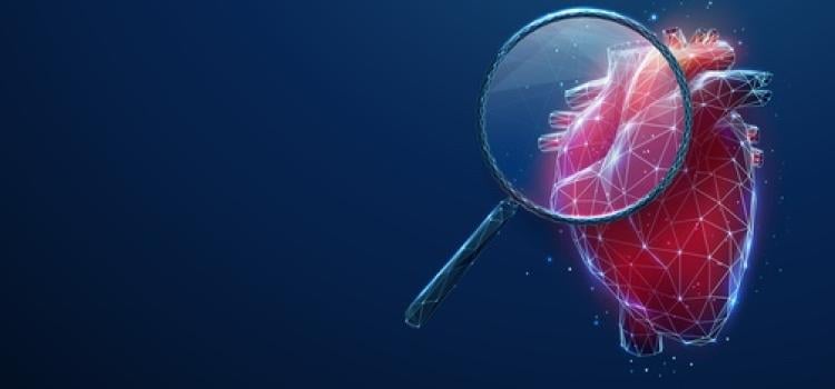 IVUS, cardiac imaging