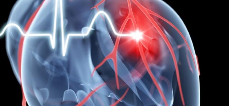 Abbott Technologies Included in Updated ESC Heart Failure Guidelines