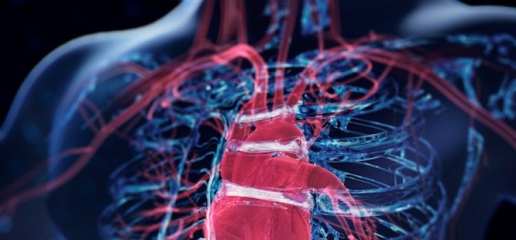 angiography, PCI, FFRangio