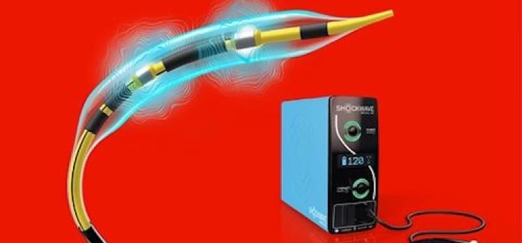 Johnson & Johnson Introduces Coronary IVL Catheter