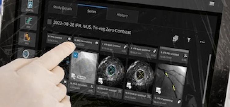 intravascular imaging,  interventional, cardiac