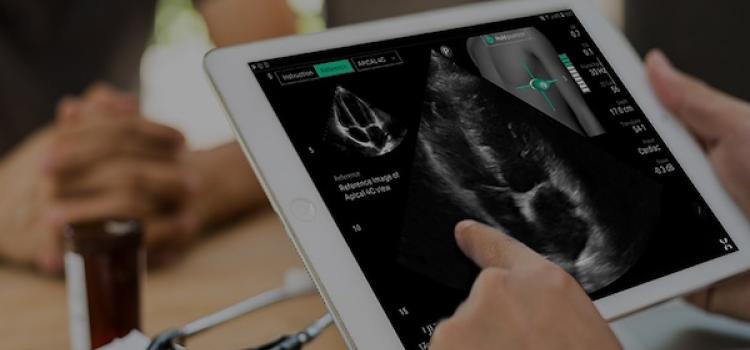 cardiac ultrasound, cardiac imaging
