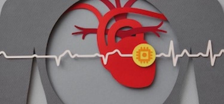 MRI, cardiac imaging, AI