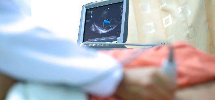 UltraSight Echocardiographic Guidance software