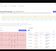 Artificial intelligence (AI)-driven health technology company, Anumana, which developed the FDA-approved ECG-AI LEF algorithm, has announced its receipt of the International Organization for Standardization (ISO) 13485 certification for its Quality Management System.