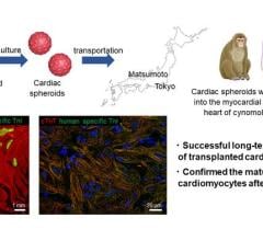 Researchers showcase an innovative strategy for regenerative heart therapy in a primate model, paving the way to clinical trials
