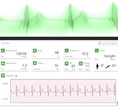 Qardio, a leading innovator in healthcare technology, has unveiled its groundbreaking Livestream solution suite, which includes continuous ECG, Blood Pressure, Pulse Oximetry (SPO2), Body Temperature, Weight, and Body Position monitoring 