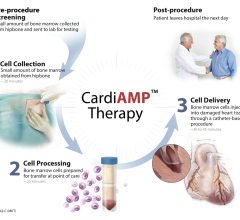 BioCardia announces that the Food and Drug Administration (FDA) has approved its proposed CardiAMP Heart Failure II study protocol 